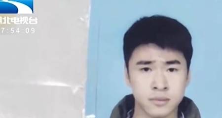 小伙|花4万多整容，鼻子歪了，嘴巴也张不开，小伙怒曝光：老了20多岁