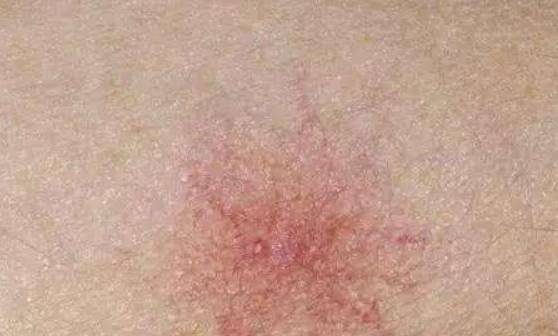 肝脏|晨起的3个习惯,或比喝酒更伤肝,劝你趁早改正,别再傻傻忽视了