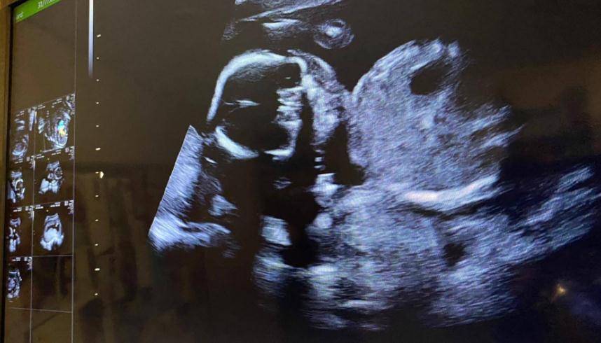 因为|恭喜！5亿驸马黎诺懿宣布爱妻怀孕19周，会让二胎用长子的旧物品