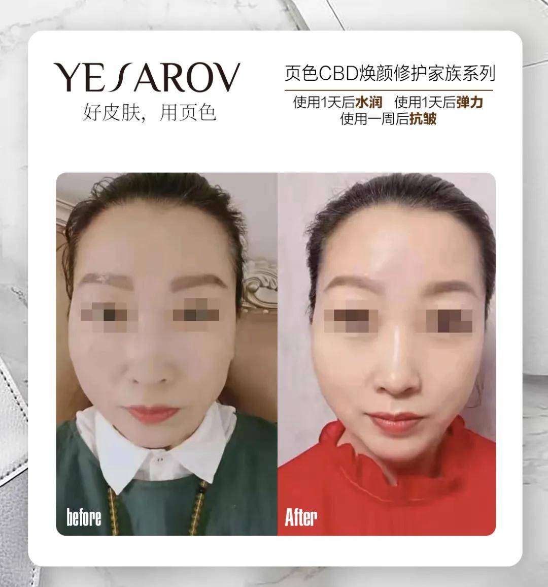 颜修|嘘，有个不成‘纹’的秘密告诉你！