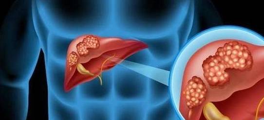 抗体|99%的人感染乙肝会自愈？提醒：同时满足这几个条件，或可转阴