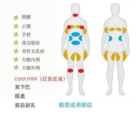 治疗|酷塑小头（cool mini）来袭，双下巴的实力克星！