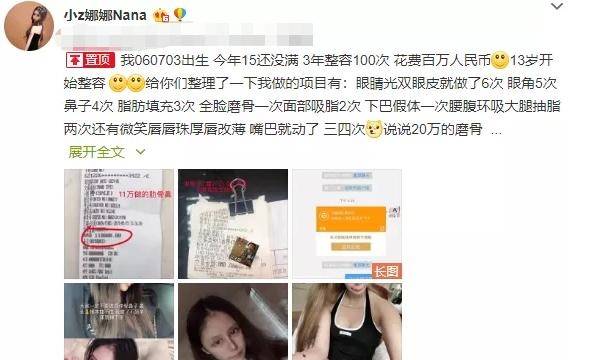 13岁女孩“整容上瘾”3年整了60多次如今“画风”不忍直视(图4)