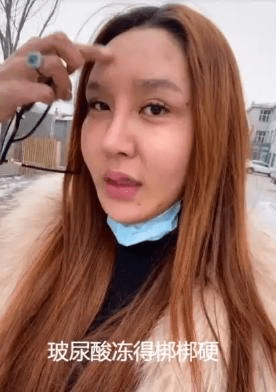 因为|女网红出现整容后遗症，脸肿成馒头眼睛睁不开，崩溃痛哭称自己要去住院了