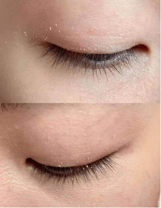 智商|女生的“智商税”真好赚，紫熨斗搓泥严重鸡肋，小黑瓶爆痘