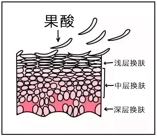 黑头|测后严选丨同样是刷酸，为何别人换脸，而你烂脸？