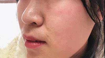 伊站|广州伊站美容中心：一招教你如何选防晒霜