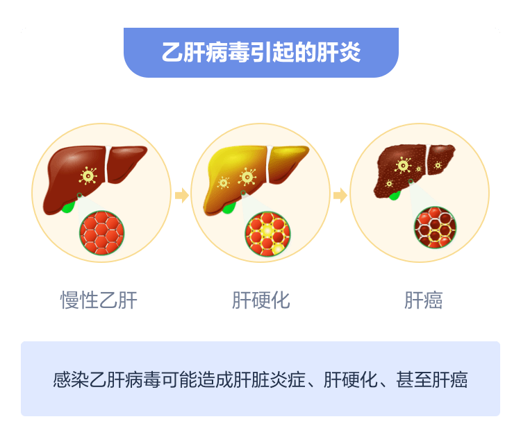 接种|世界肝炎日 | 一起守护你我的小心“肝“