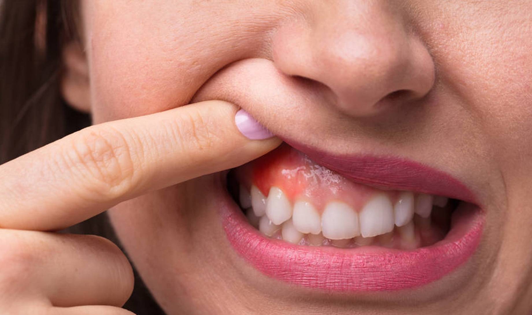 牙龈|糖尿病请注意：这5个不易察觉的症状，也是并发症来临的信号