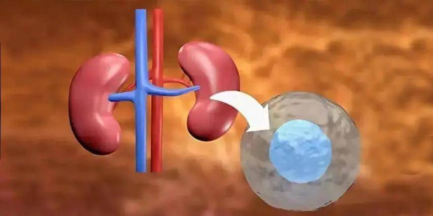 肾脏|干细胞 | 让尿毒症患者不再别无选择