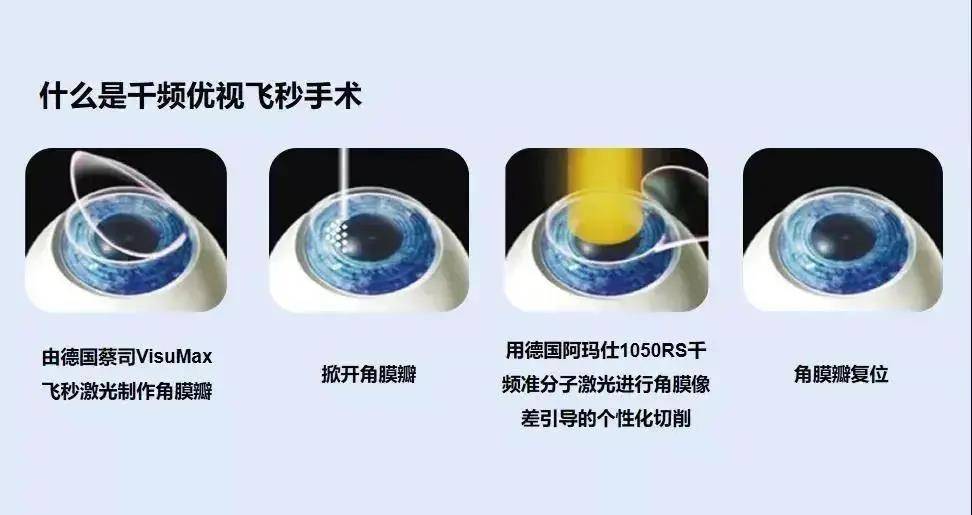 激光|普瑞眼科|“你真的了解吗” 想做近视手术先来看一看