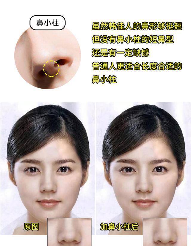 挺翘|为什么韩佳人小翘鼻被整形模板淘汰了？她凭什么成为新美鼻模板？