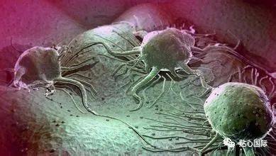 hpv病毒会感染肺吗 3622133f61174e61a2aec4fd4af7ddfa.jpeg