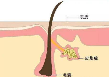 康如|有哪些孕妇可用的洗发水？堪称夏日“吸油纸”，油头细软塌必看