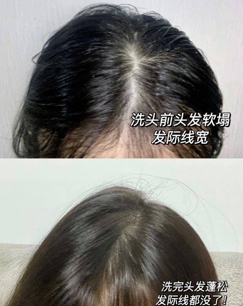 康如|有哪些孕妇可用的洗发水？堪称夏日“吸油纸”，油头细软塌必看