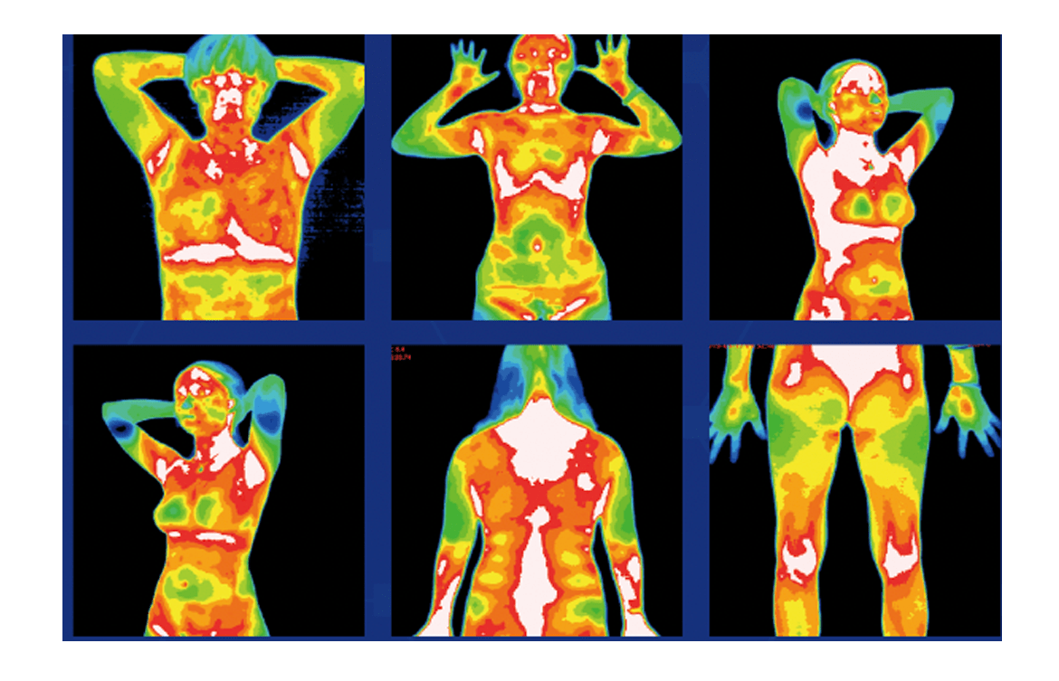 tmt医用红外热成像检测,中医热ct!_人体