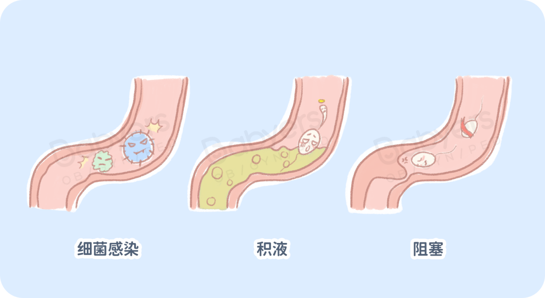 子宫|输卵管一堵，精子卵子都要哭！