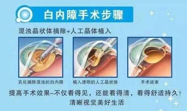 年紀都大了做白內障手術還有必要嗎