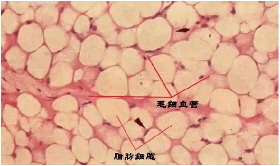 永久|脂肪填充10天就快没了，不是永久保持?这么快就吸收了，白做了？