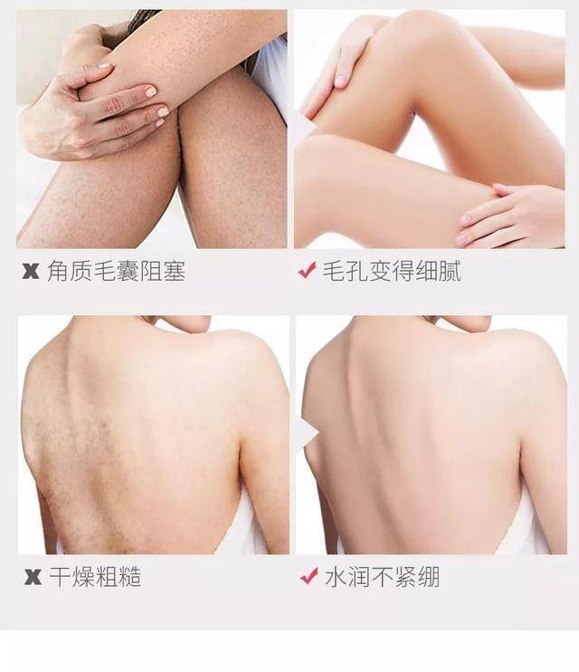 因为|26岁昆凌美背撩人，上万衣裙藏不住凹凸感，俩娃妈不简单