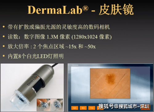 治疗|皮肤胶原流失多少，丹麦皮肤超声告诉你！