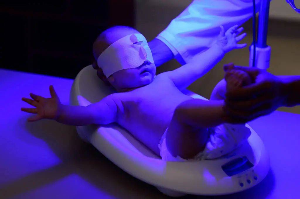 母婴商盟新生儿黄疸怎么科学解决