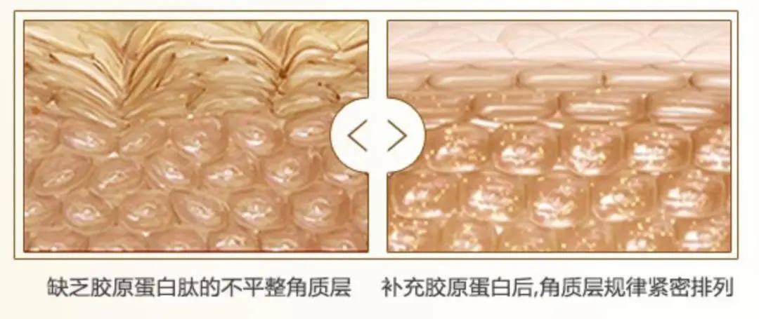 方法|爱兰诗 | 法令纹又深又显老，这个方法轻松让它消失！