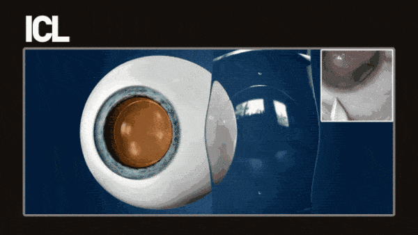 3d580a4f200c49e4a2d2adb8130d3eea.gif