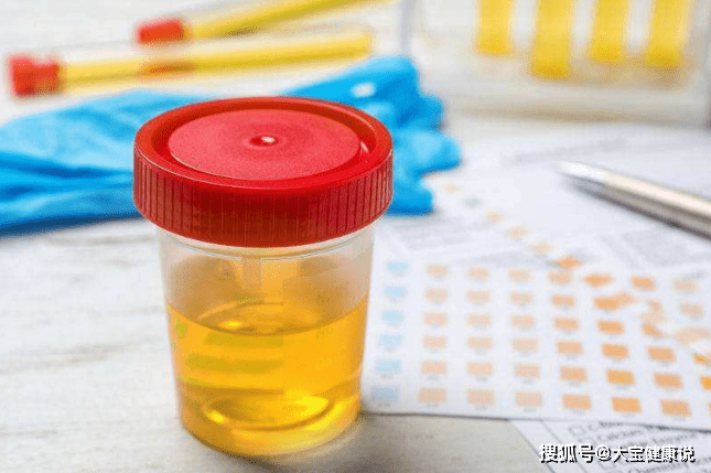 肾脏|糖尿病患者，排尿时有一些变化，可能是尿毒症的早期征兆！