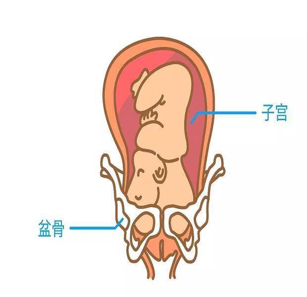 28周还是臀位怎么办