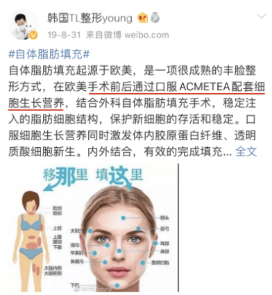 下巴|老实说：面部填充好吗，自体脂肪垫下巴行不行，靠谱吗？