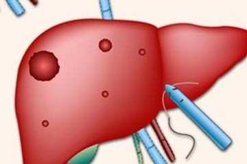 症状|肝脏健不健康，这几个地方就能看出来，一般很难藏住！
