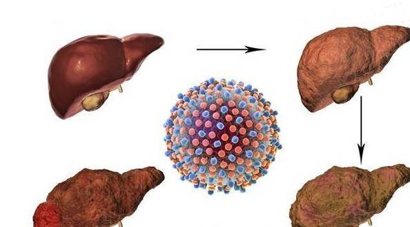 症状|身上3处变黑2处变臭，夜里2个时间总惊醒，可能是肝脏在“求助”