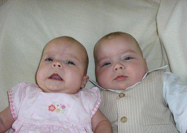 成长|双胞胎生下来就没穿过衣服，不是父母狠心，而是穿不得，这是为什么？