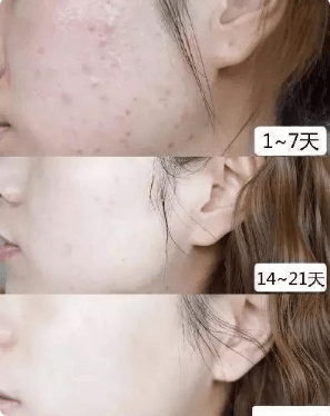 脸部|赵丽颖近照曝光，离开了十级精修后，皮肤状态过于真实了！