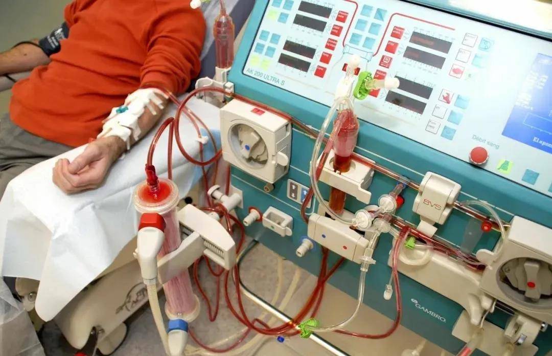 饮食|透析前该怎么吃,才有好的透析效果呢?