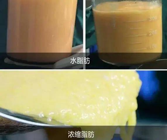 自体脂肪丰胸要填充几次才可以韦元强给出答案