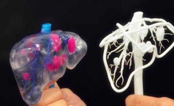 肝脏|早上属于养肝黄金期，坚持吃5类早饭，肝脏或许会“感激”你！