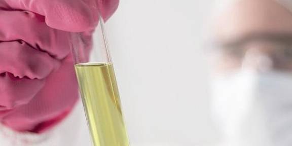 红细胞|尿蛋白、肌酐等指标轻微超标，事儿大吗？最后2个指标有大害