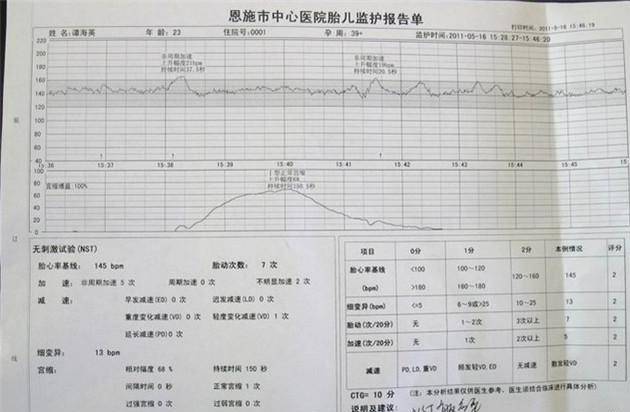 几个月做胎心监护啊 a86995ef19fc41cf9ceaf2d96c6da56e.jpeg