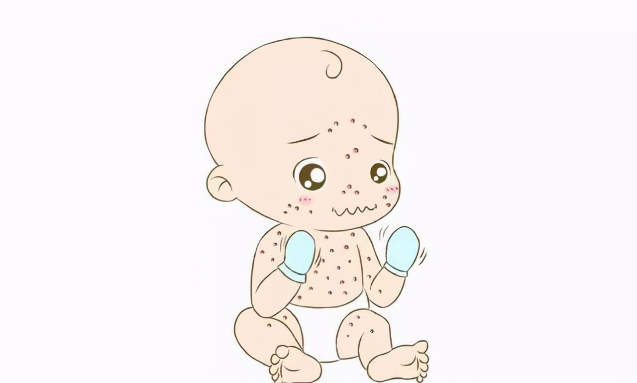 不想宝宝皮肤干燥过敏这些方法帮你搞定