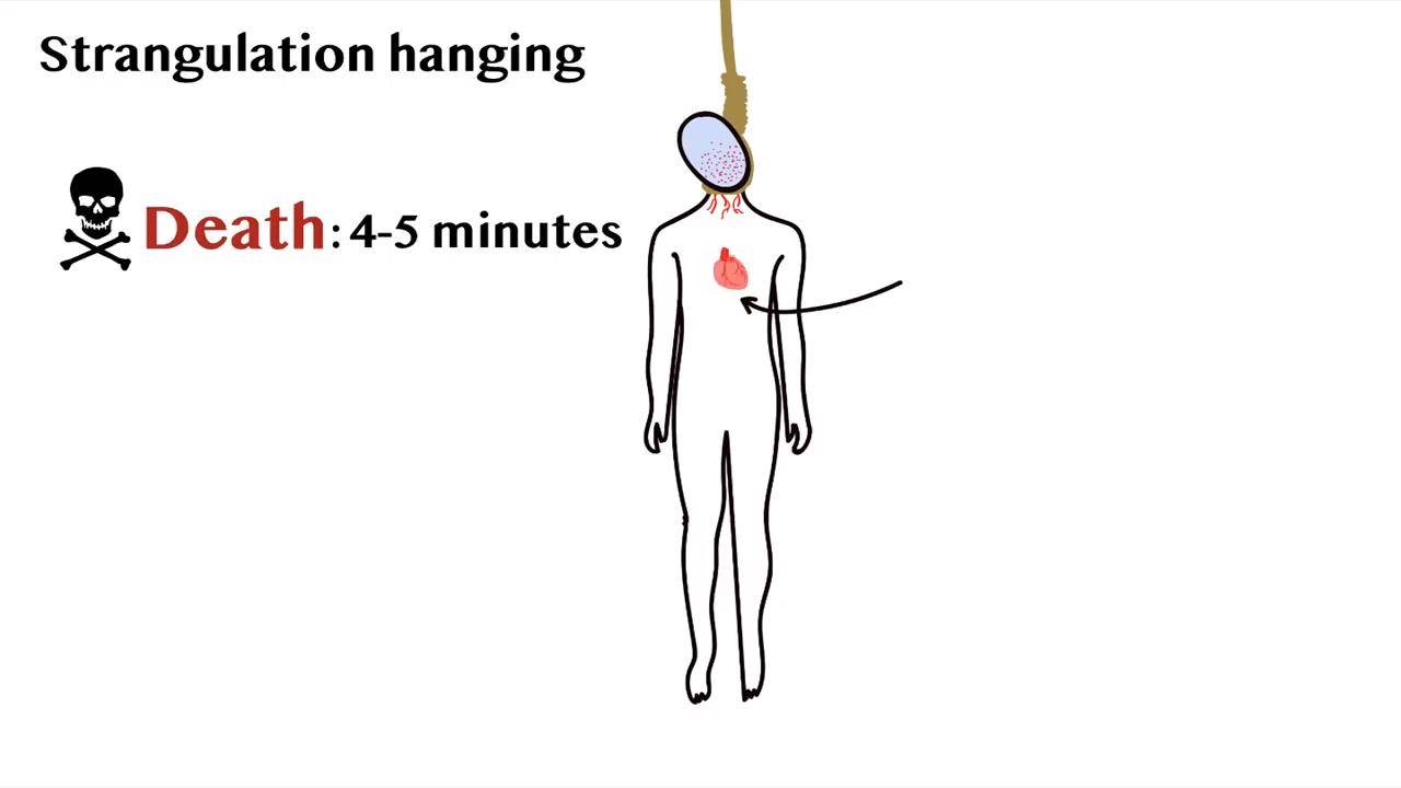 什么原因会引起脑水肿 01819590c94344e8932198e1f23422be.jpeg