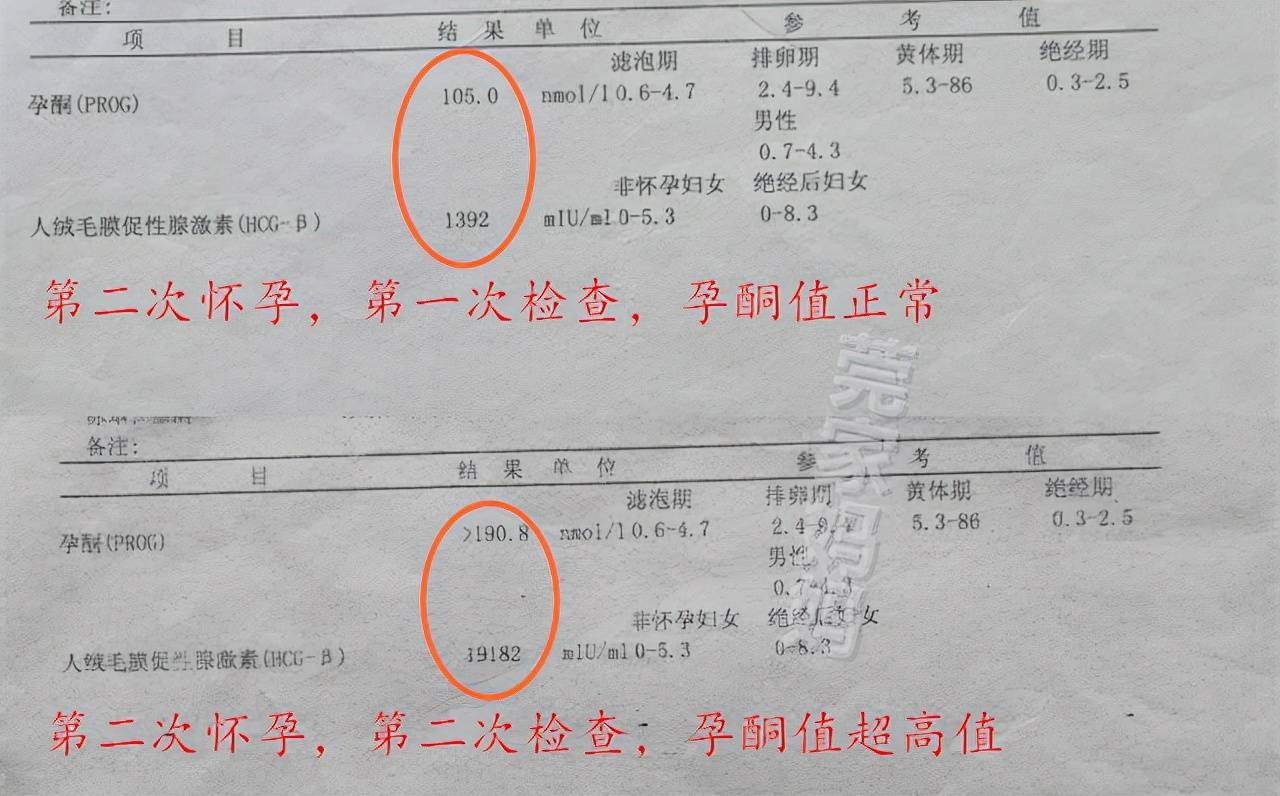 智商|盘点怀孕生娃时交过的“智商税”，希望你别中招，孕妈要“避坑”