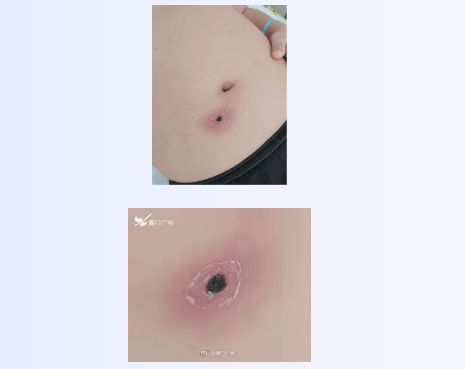 阿姨|可怕！2人高烧不退，核酸阴性！近期千万当心！