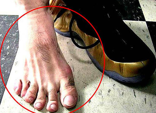 世界上最长的脚趾图片
