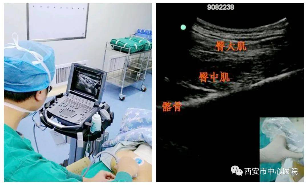 病房|西安市中心医院疼痛科——全新住院病房正式投入使用