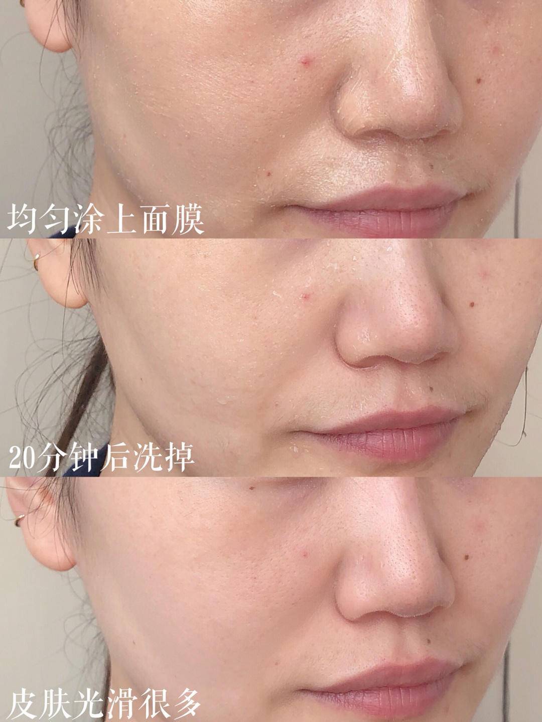 因为|好爽~每个毛孔都在呼吸的感觉太好了！