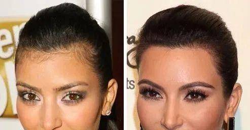 调整|赵露思调整发际线后显瘦10斤？提升颜值，拯救发际线小妙招来了！