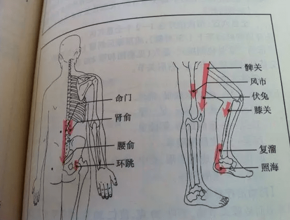 艾灸对股骨头坏死病情的恢复有效果吗