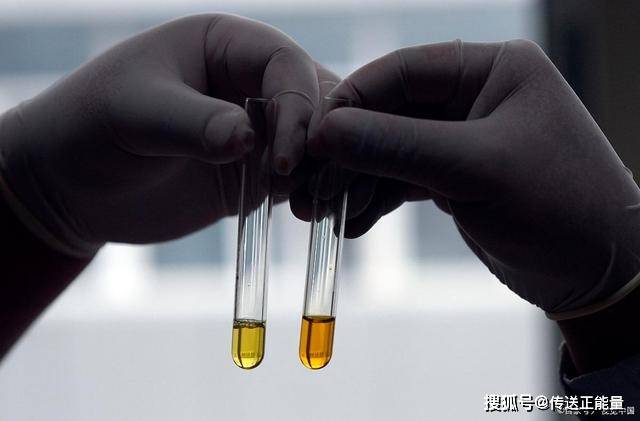 肝脏|肝病是“拖”出来的？频繁出现这些“异常”，是肝脏的“求救”信号